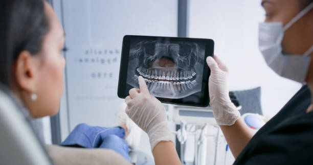 Licensed Teeth Cleaning And Checkup service in High Point, FL - Smile Center Dentistry